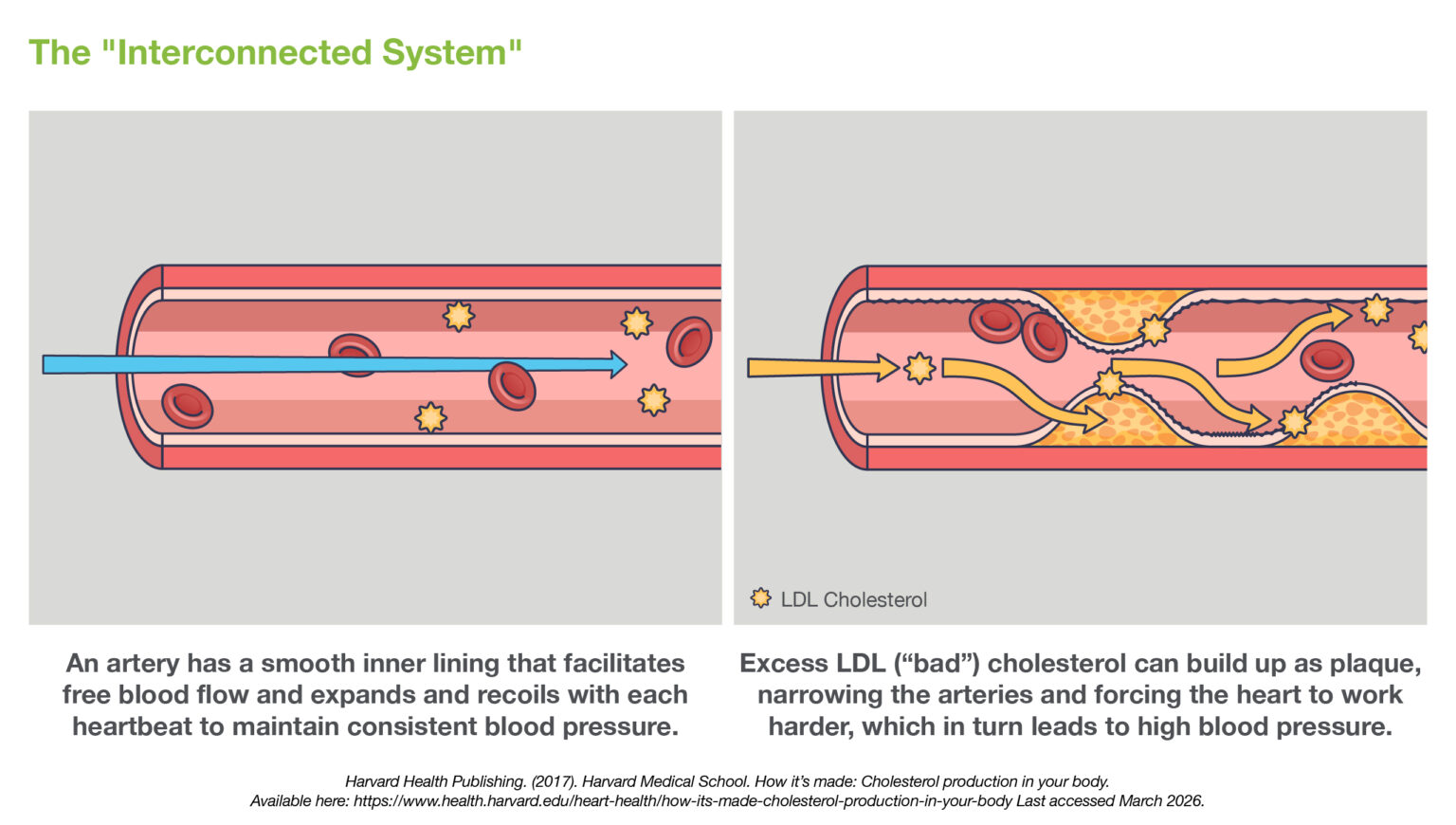 The hidden link between high blood pressure and cholesterol